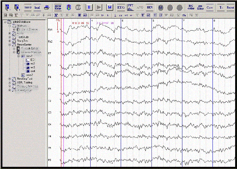 Epidome-5-nzoy32wpjmg45oyhk06dfmmgjf6lh9w53nn8qdulx8